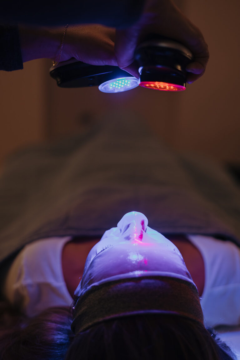 IPL Hyperpulse Blue-Light