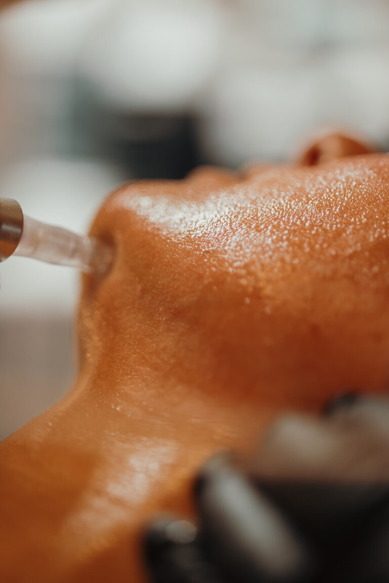 Medizinisches Microneedling